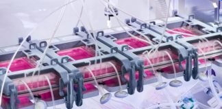 Empresa suiza desarrolla la primera máquina que multiplica piel para injertos