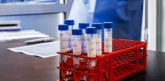 Corea del Norte desarrolla su propio kit para realizar pruebas PCR Kit ára pruebas pcr