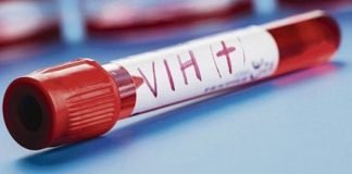 Alertan en Monagas sobre repunte de casos de VIH-SIDA