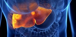 Argentinien entdeckt den ersten lateinamerikanischen Fall von akuter Hepatitis unbekannten Ursprungs bei Kindern