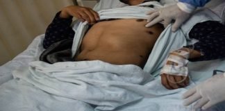 Paciente dio positivo a Covid-19, viruela del mono y VIH