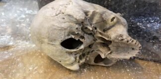 Descubren una calavera humana en un envío postal de Argentina