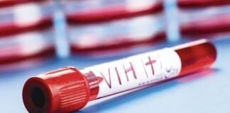 En Zulia y Distrito Capital una de cada 300 personas vive con VIH