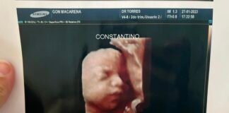 Clínica entregó la misma ecografía a tres embarazadas