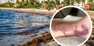 Encontraron bacterias carnívoras en el sargazo de Florida