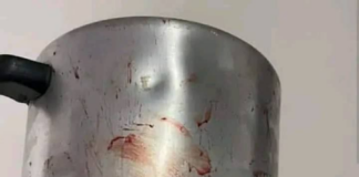 Detienen a mujer por agredir a su pareja con una olla de presión en Yaracuy