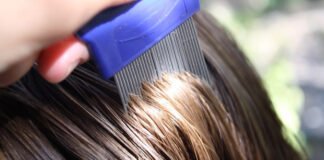 Vegana rechaza eliminar piojos de su hija porque son «seres sintientes»