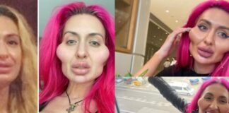 Así es la mujer con las mejillas más grandes del mundo