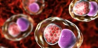 Infecciones de Transmisión Sexual – ITS, año 2023- Por Deyson Padrón