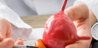 El cáncer de próstata es la principal causa de mortalidad masculina en Venezuela