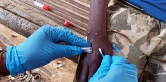 Tailandia confirma el primer caso de la nueva variante de mpox