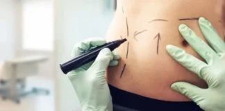 México: cómo la narcoestética está cambiando el cuerpo de las mujeres de Sinaloa