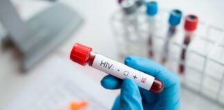Escasez de reactivos y poca prevención limitan lucha contra el VIH en Venezuela