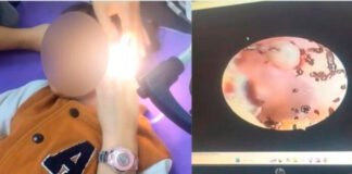 Niña se queja de dolores en el cuello y cabeza y descubren cientos de garrapatas en su oído