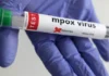 La epidemia de Mpox no remite en África, que registra una media de 3.000 casos semanales