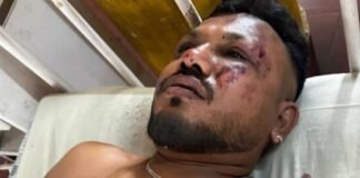 Así salió caminando el único sobreviviente del avión de Air India que se estrelló con 242 personas a bordo