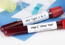 Condenada enfermera por infectar a más de 70 personas de VIH y Hepatitis C en Rusia