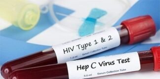 Condenada enfermera por infectar a más de 70 personas de VIH y Hepatitis C en Rusia