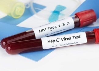 Condenada enfermera por infectar a más de 70 personas de VIH y Hepatitis C en Rusia