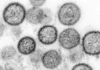 CONFIRMAN QUE EL BROTE DE HANTAVIRUS EN CRUCERO ES DE LA CEPA ANDES, LA MÁS TRANSMISIBLE ENTRE HUMANOS