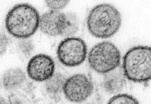 CONFIRMAN QUE EL BROTE DE HANTAVIRUS EN CRUCERO ES DE LA CEPA ANDES, LA MÁS TRANSMISIBLE ENTRE HUMANOS