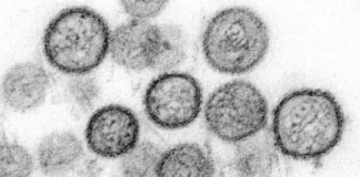 CONFIRMAN QUE EL BROTE DE HANTAVIRUS EN CRUCERO ES DE LA CEPA ANDES, LA MÁS TRANSMISIBLE ENTRE HUMANOS
